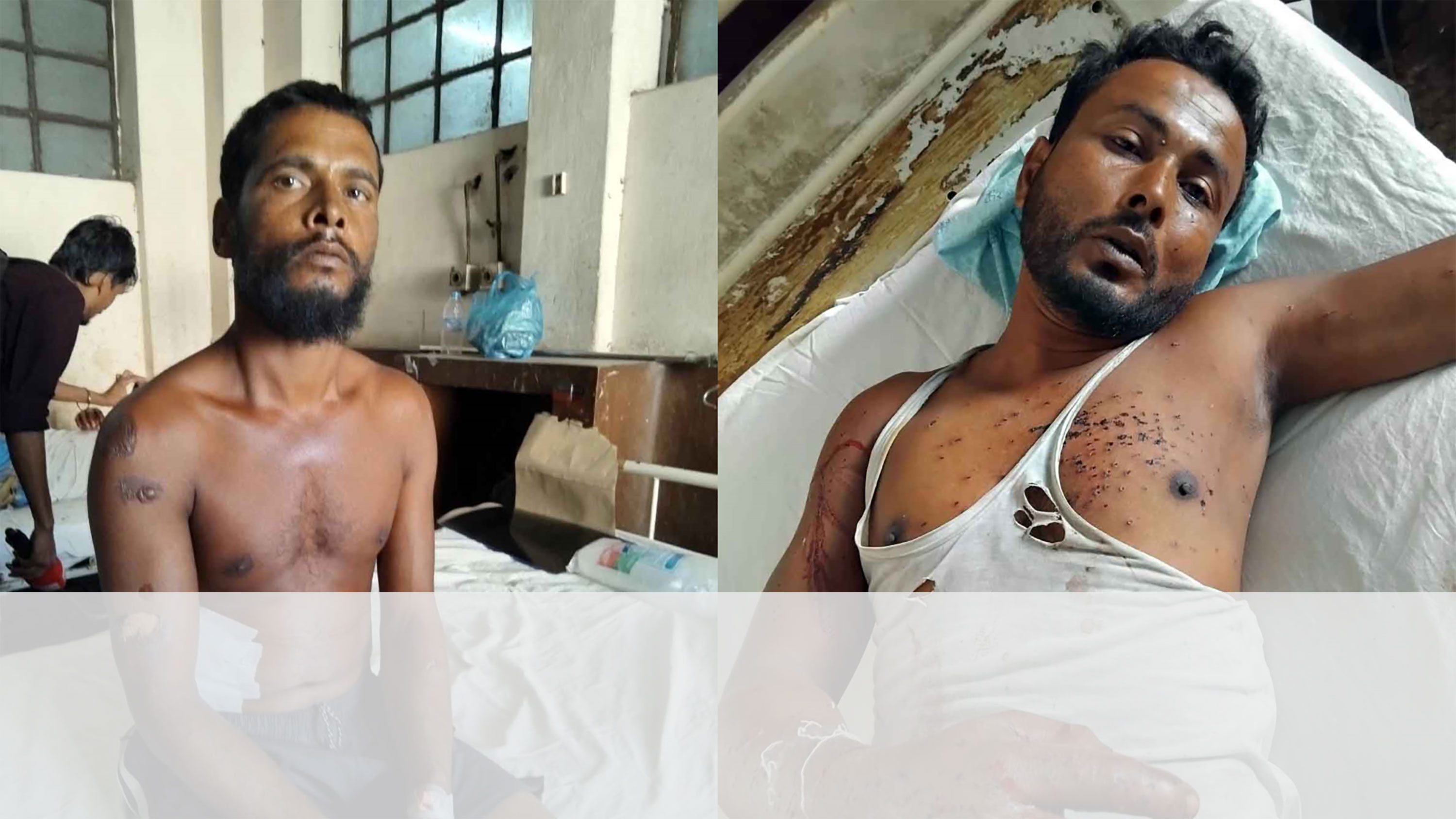 বিএসএফের ককটেল ও শর্ট গানের গুলিতে আহত দুই ভারতীয় নাগরিক রমেক হাসপাতালে ভর্তি