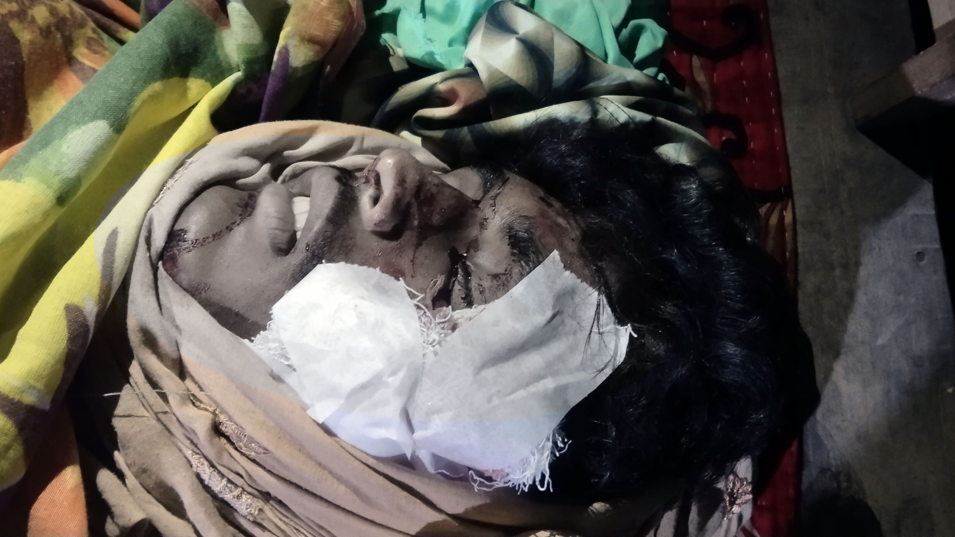 কালীগঞ্জে দাঁড়িয়ে থাকা ট্রলির পেছনে মোটরসাইকেলের ধাক্কা, চালক নিহত,আহত-২